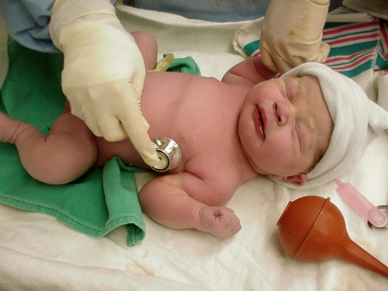 neonato